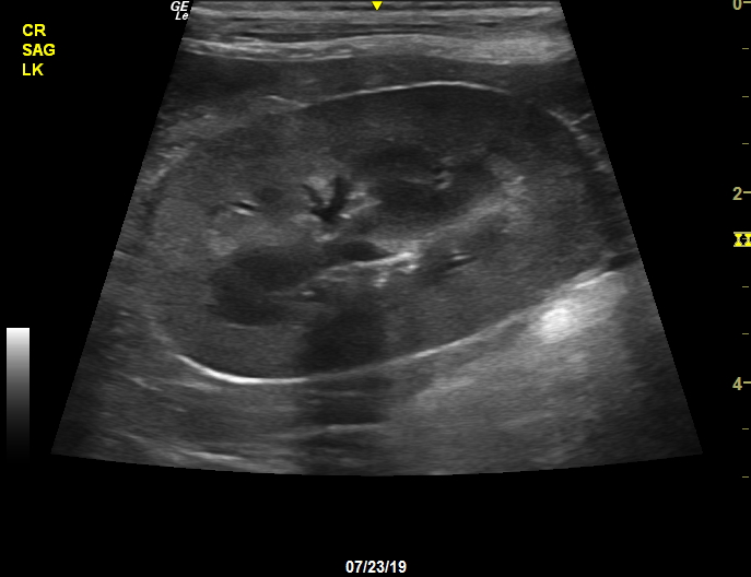 Ultrasonography